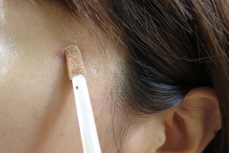 赤くなってしまった大人ニキビ…コンシーラーで上手にカバーする方法