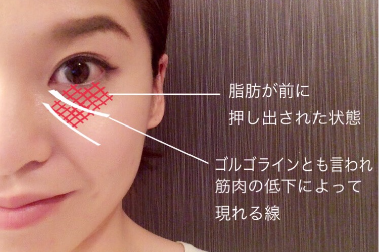 目元をケア