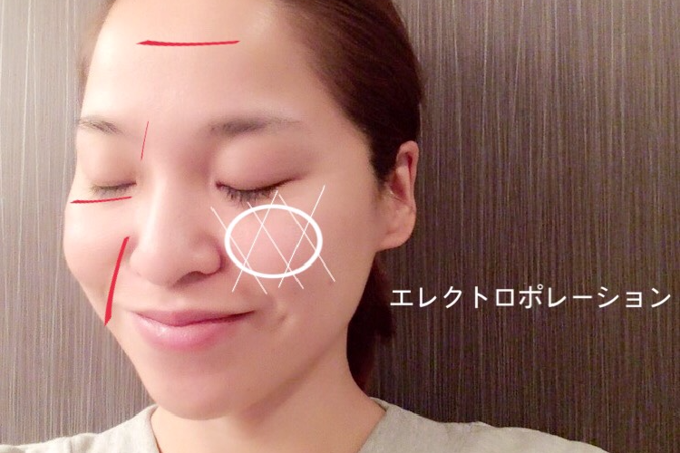 エレクトロポレーション