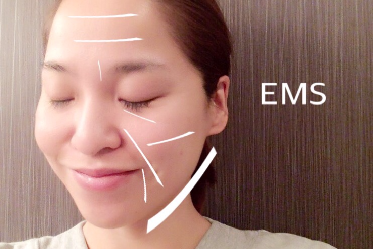 EMS
