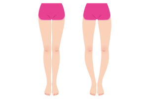 O脚を改善するために意識してほしいたった1つのこととは？