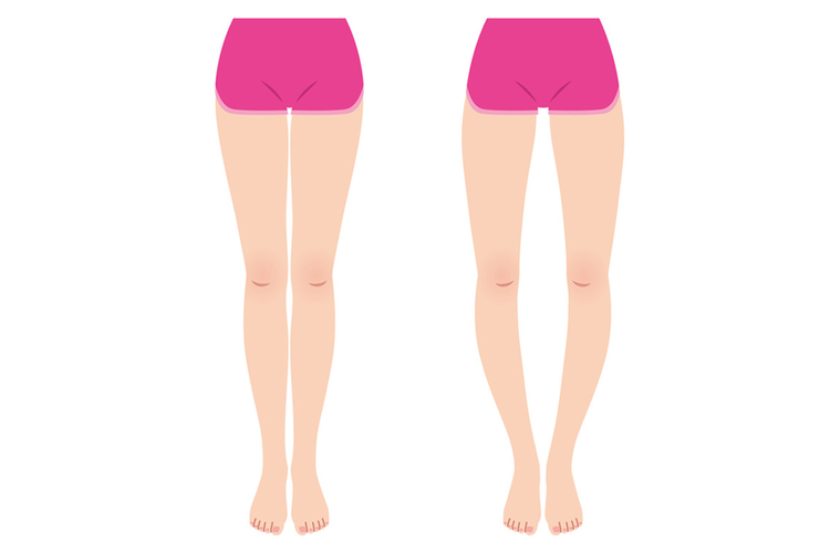 O脚を改善に導くストレッチの注意点