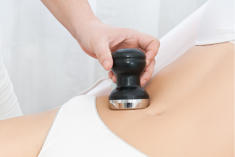 キャビテーション　エステ