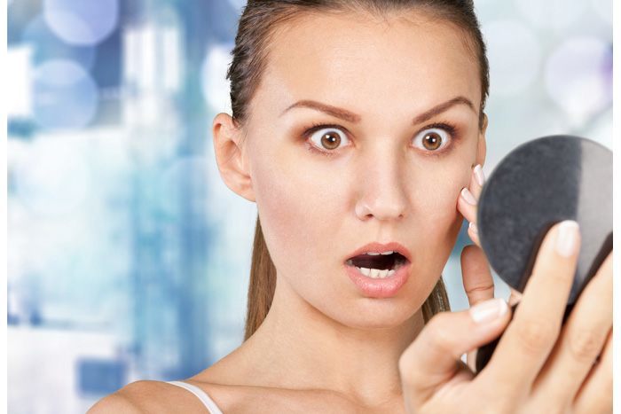 繰り返しできる大人ニキビを解消する方法6つ