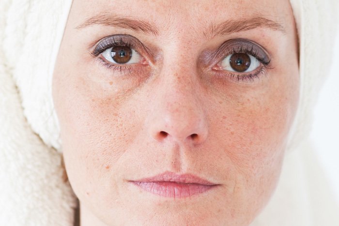 毛穴の開きが気になる人必見!今すぐ見直したいNG習慣5選