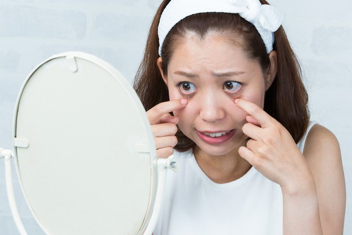クマの原因は寝不足だけじゃなかった!色素沈着からの「茶クマ」に要注意