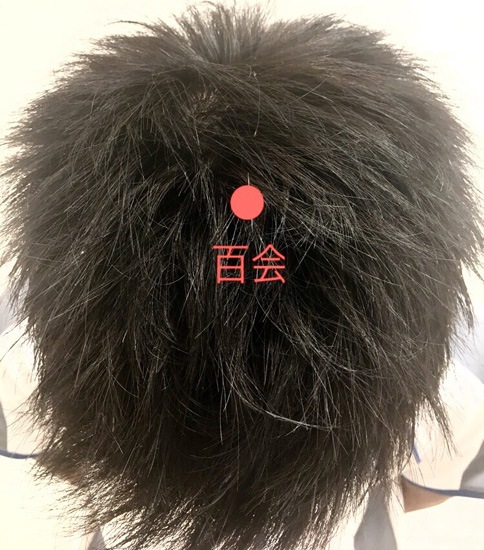 百会（ひゃくえ）のツボのイメージ