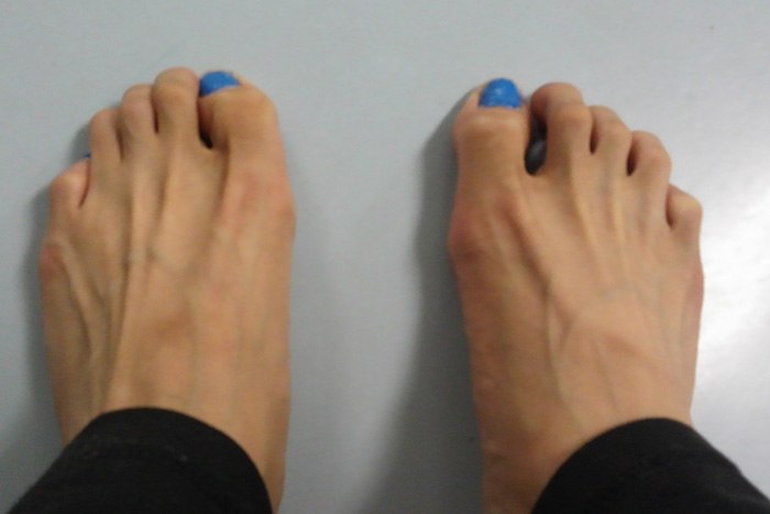 足指のイメージ