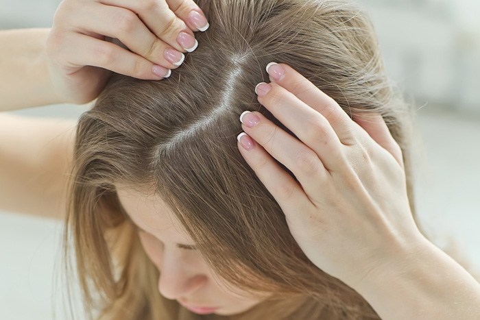 ヘアダメージのイメージ