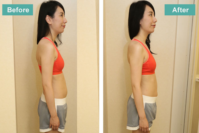 東さんがモンテセラピーを受ける前と後の写真