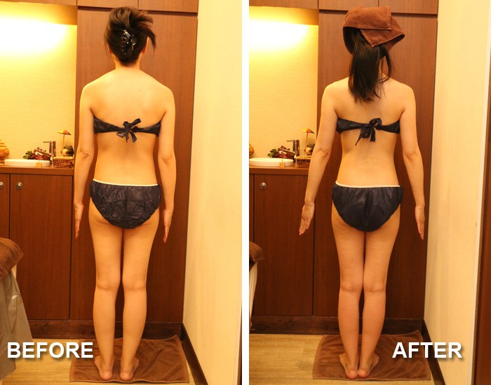 『深部リンパ節開放フラッシュセルバーンコース』後ろ姿のBEFORE・AFTER